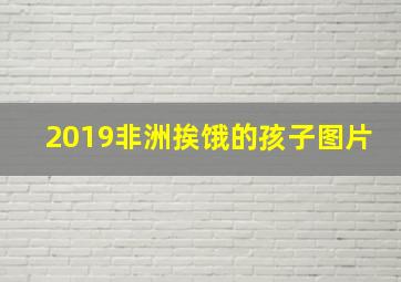 2019非洲挨饿的孩子图片