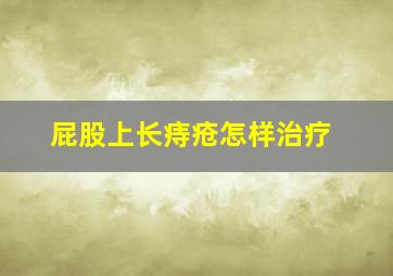 屁股上长痔疮怎样治疗