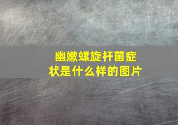 幽嫩螺旋杆菌症状是什么样的图片