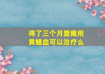 得了三个月面瘫用黄鳝血可以治疗么