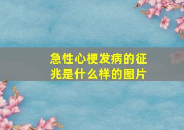 急性心梗发病的征兆是什么样的图片