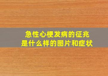 急性心梗发病的征兆是什么样的图片和症状