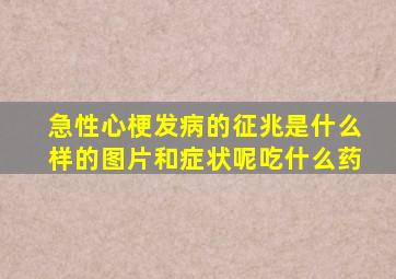 急性心梗发病的征兆是什么样的图片和症状呢吃什么药