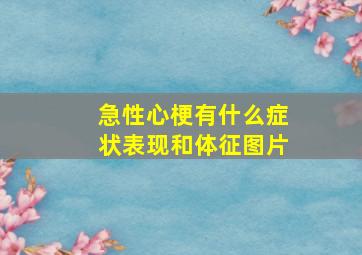 急性心梗有什么症状表现和体征图片