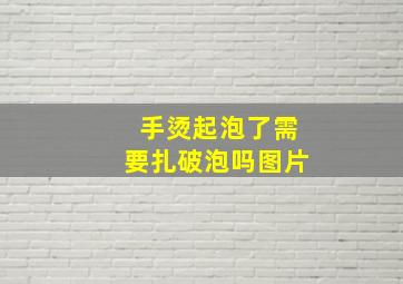 手烫起泡了需要扎破泡吗图片