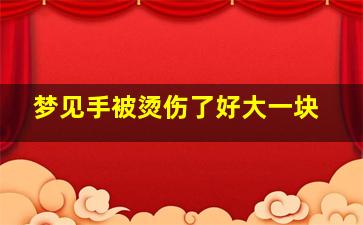 梦见手被烫伤了好大一块