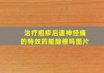 治疗疱疹后遗神经痛的特效药能除根吗图片