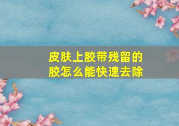 皮肤上胶带残留的胶怎么能快速去除