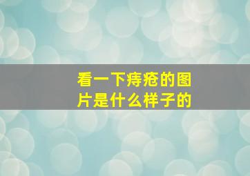 看一下痔疮的图片是什么样子的