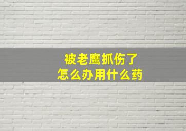 被老鹰抓伤了怎么办用什么药