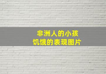 非洲人的小孩饥饿的表现图片