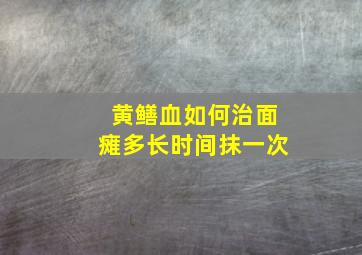 黄鳝血如何治面瘫多长时间抹一次